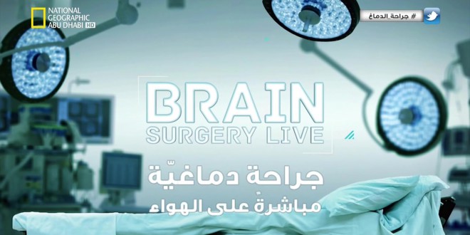 وثائقي جراحة الدماغ مباشرة على الهواء