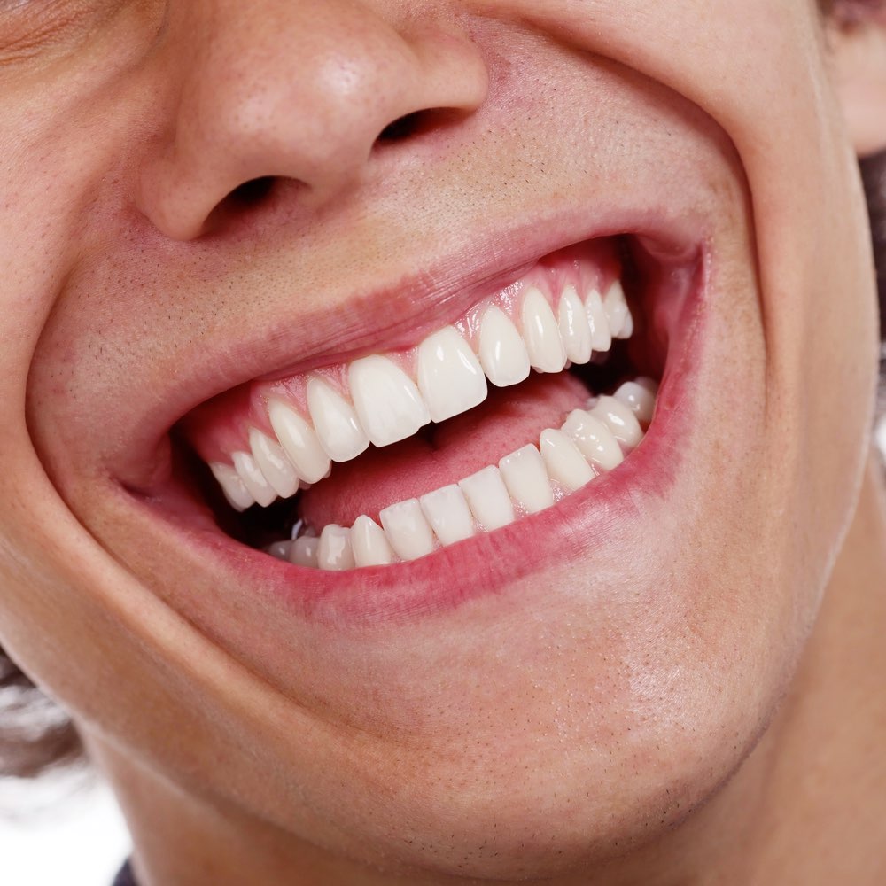 مقال - ما مدى فعالية الوصفات المنزلية لتبييض الأسنان؟