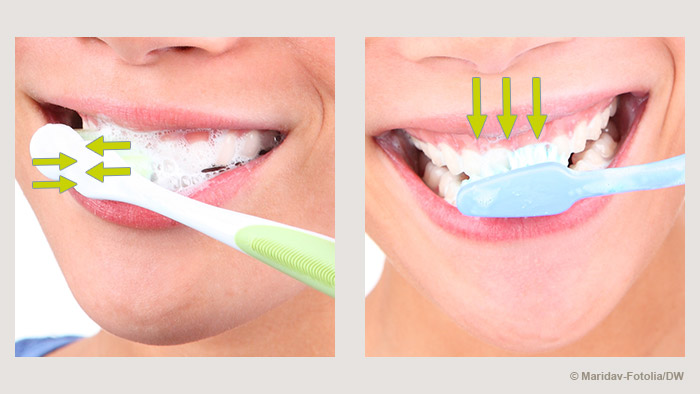 التنظيف الصحيح للأسنان