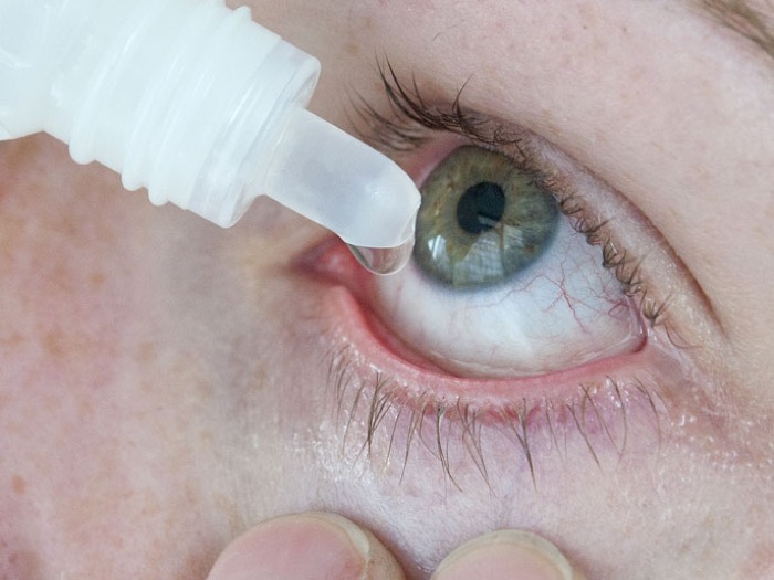 مقال : جفاف العين .. الأسباب و العلاج