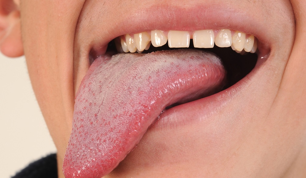 مقال – لماذا تُشفى جروح الفم بسرعة فائقة؟