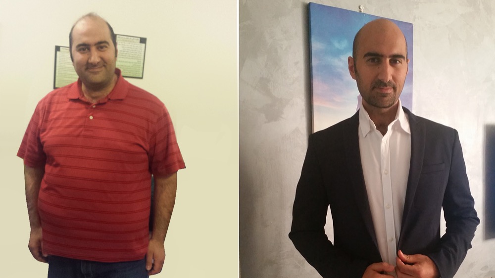 مقال - حميد أيوب: كيف فقدت 75 كلغ من وزني؟