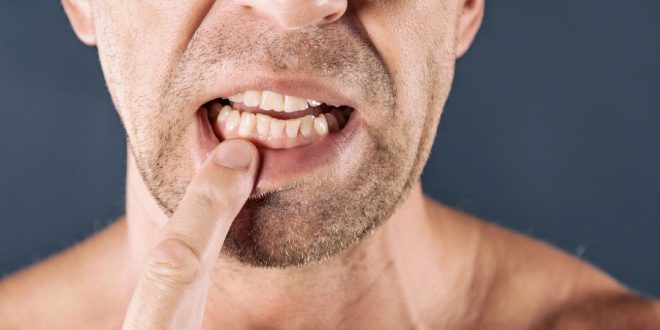 مقال – 5 طرق للحفاظ على أسنانك مع تقدم العمر