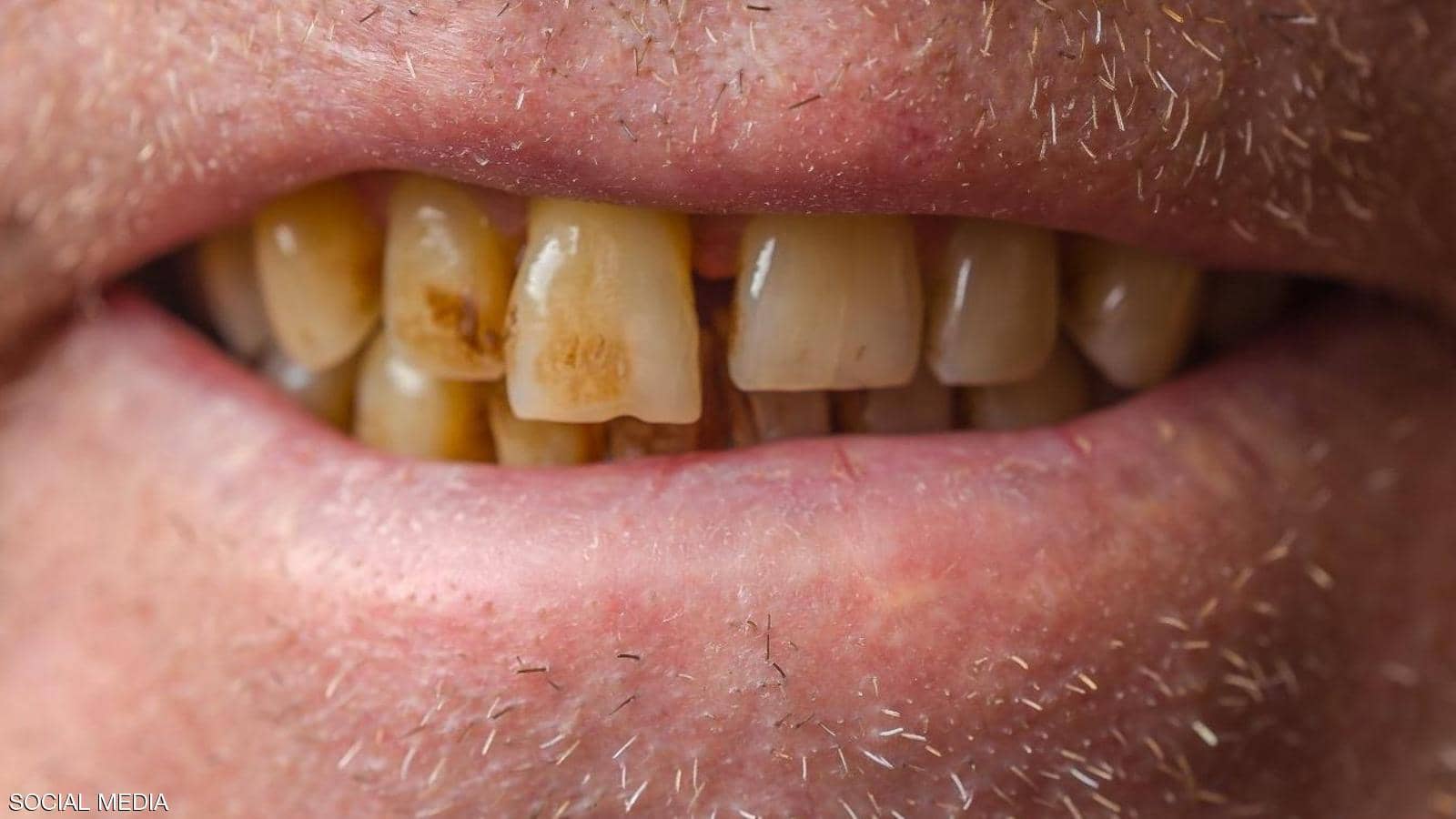 مقال – كيف تحمي أسنانك من "لون القهوة"؟