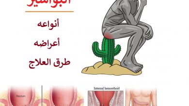 ماهي اعراض البواسير ، أنواعه و طرق العلاج ؟
