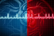 ما هي أسباب دقات القلب السريعة ؟