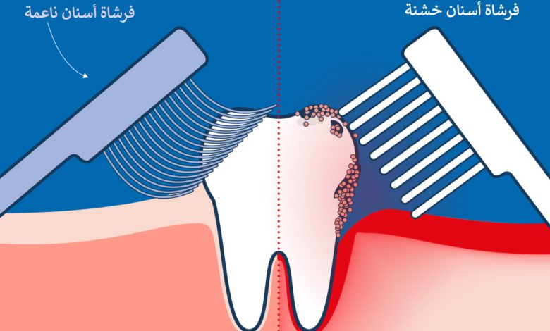 أيهما أفضل فرشاة الأسنان الخشنة أم الناعمة ؟