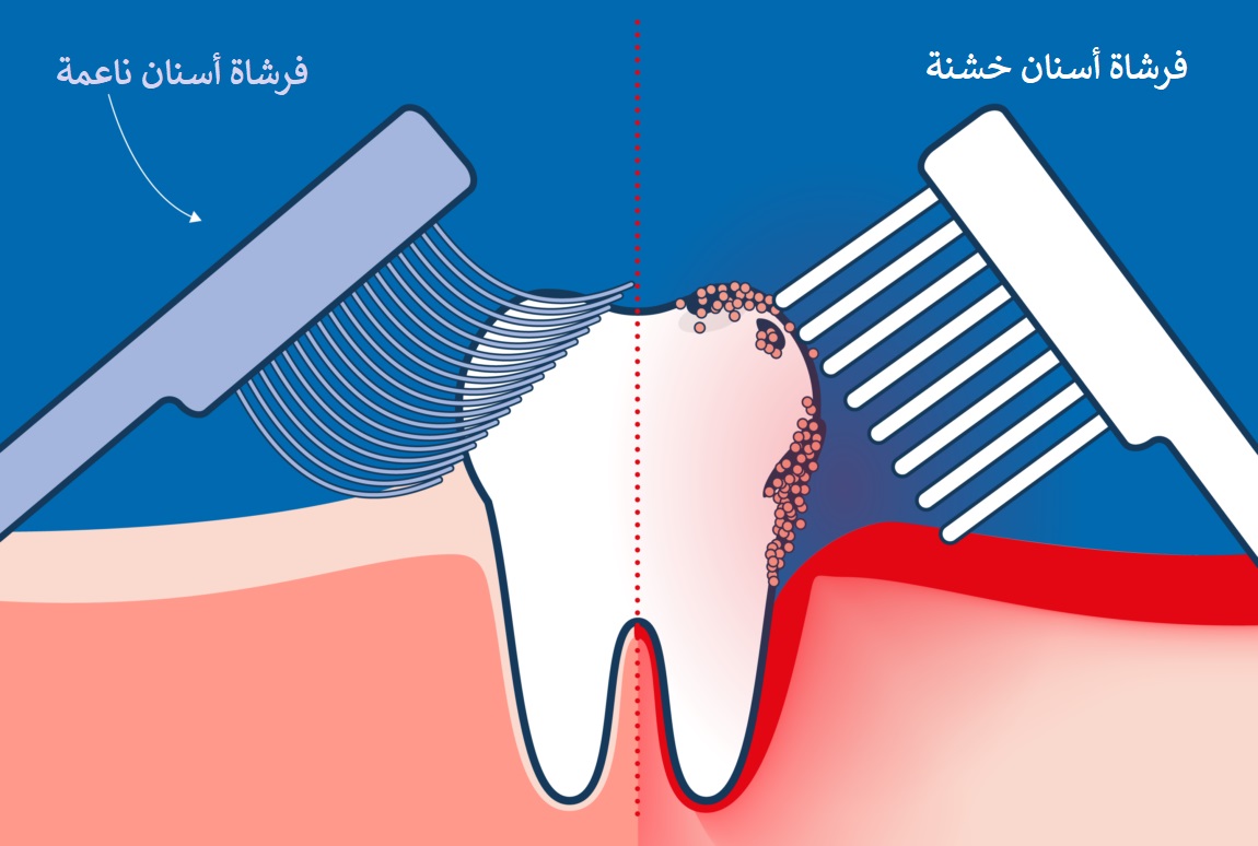 أيهما أفضل فرشاة الأسنان الخشنة أم الناعمة ؟