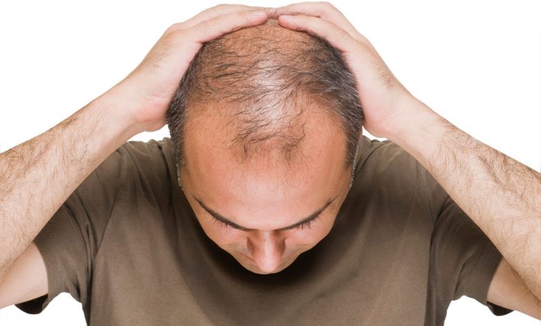 كيف يؤثر الإجهاد و التوتر على صحة الشعر؟