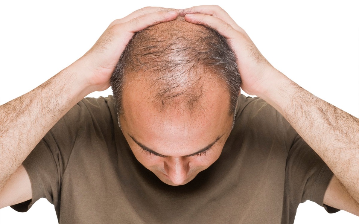 كيف يؤثر الإجهاد و التوتر على صحة الشعر؟